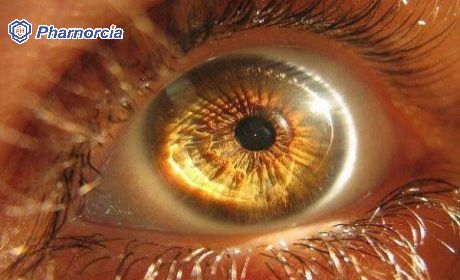 Lightweight Technology-pharnorcia Silicone Hydrogel Contact ...